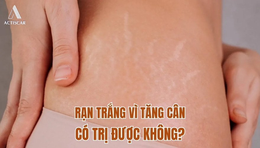 Có thể trị rạn trắng do tăng cân hay không