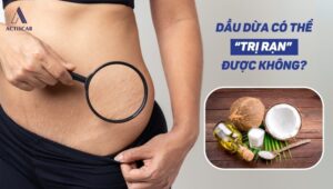 Dầu dừa có thể trị rạn được hay không