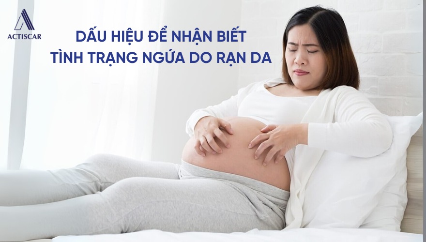 Dấu hiệu nhận biết tình trạng ngứa do rạn da