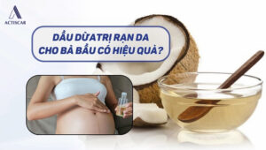 Dùng dầu dừa trị rạn da cho bà bầu có hiệu quả không