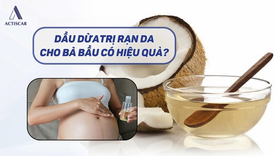 Dùng dầu dừa trị rạn da cho bà bầu có hiệu quả không