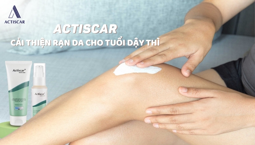 Giải pháp cải thiện rạn da chân tuổi dậy thì