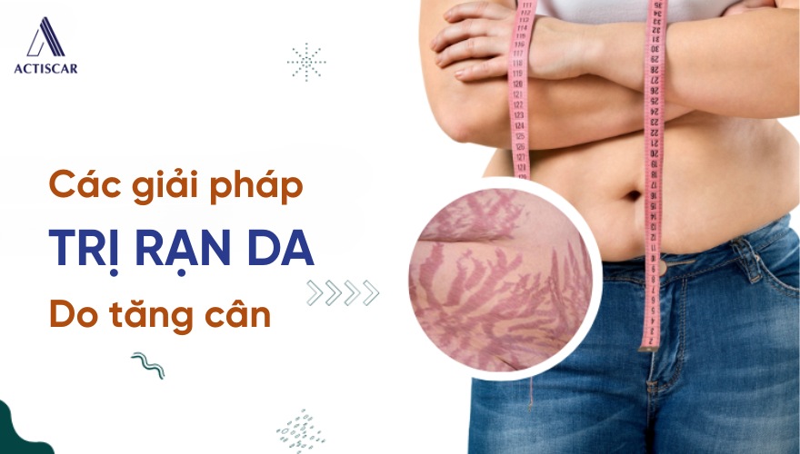 Giải pháp trị rạn da đỏ khi tăng cân cân hiệu quả