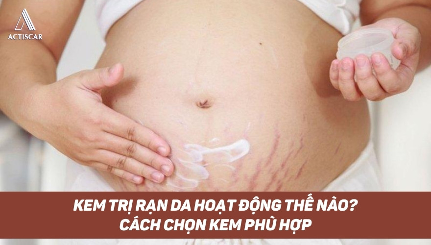 Kem trị rạn da hoạt động thế nào