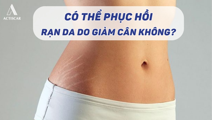 Có khả năng phục hồi rạn da sau khi giảm cân không