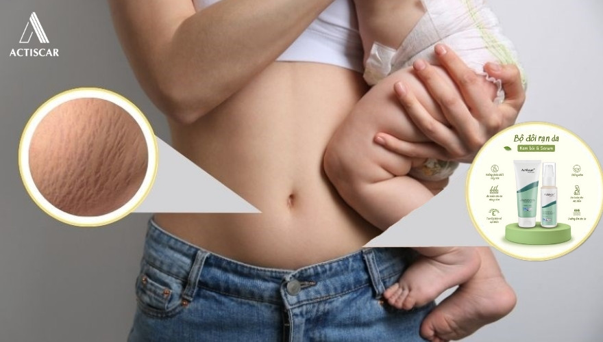 Khi nào nên sử dụng phương pháp mờ rạn chuyên sâu