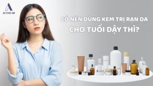 Nên sử dụng kem trị rạn da cho tuổi dậy thì không