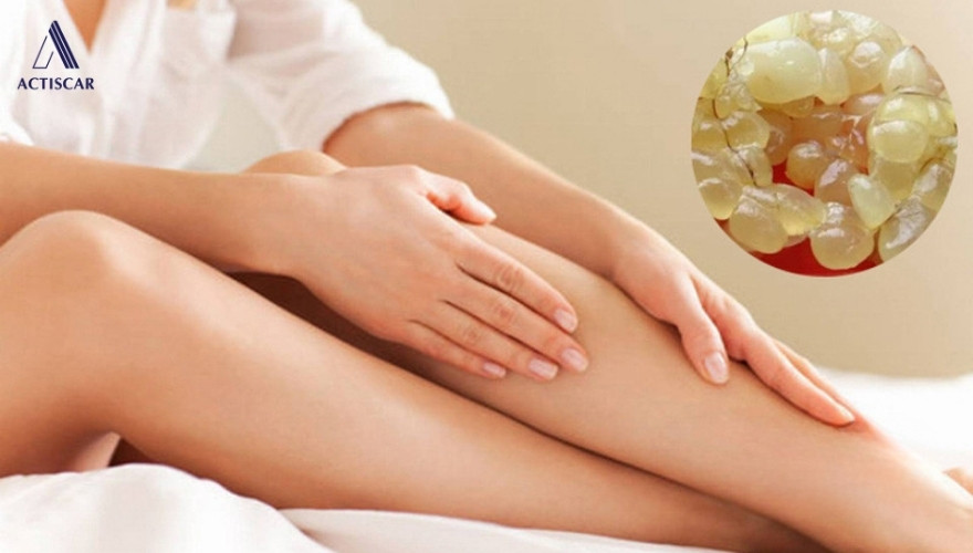 Những lưu ý khi trị rạn da bằng mỡ trăn