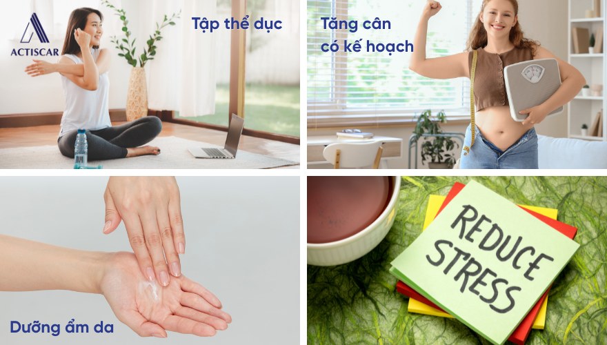 Phòng ngừa rạn đỏ tái phát khi tăng cân