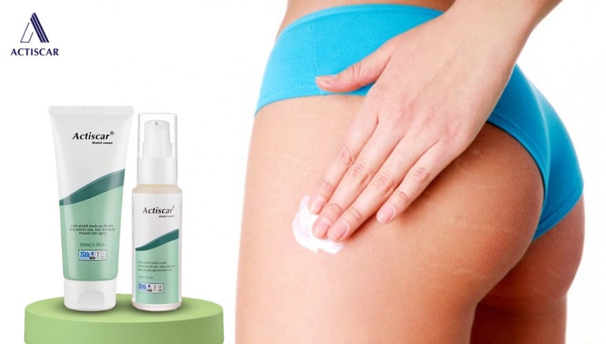 Phương pháp cải thiện rạn với bộ đôi mờ rạn Actiscar