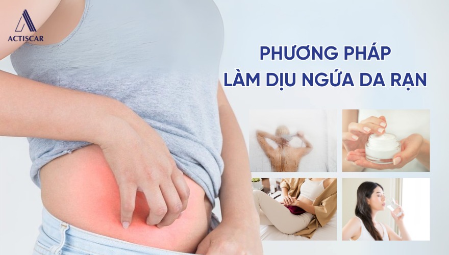 Phương pháp giúp giảm vết rạn da bị ngứa sau sinh