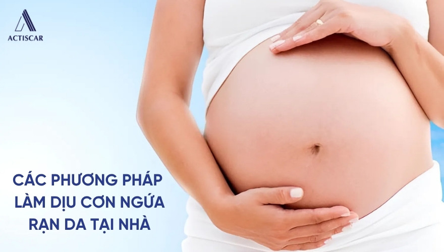 Phương pháp làm dịu cơn ngứa do rạn da