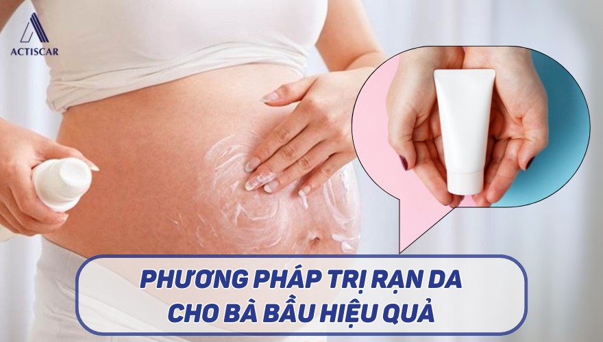 Phương pháp trị rạn da cho bà bầu tại nhà