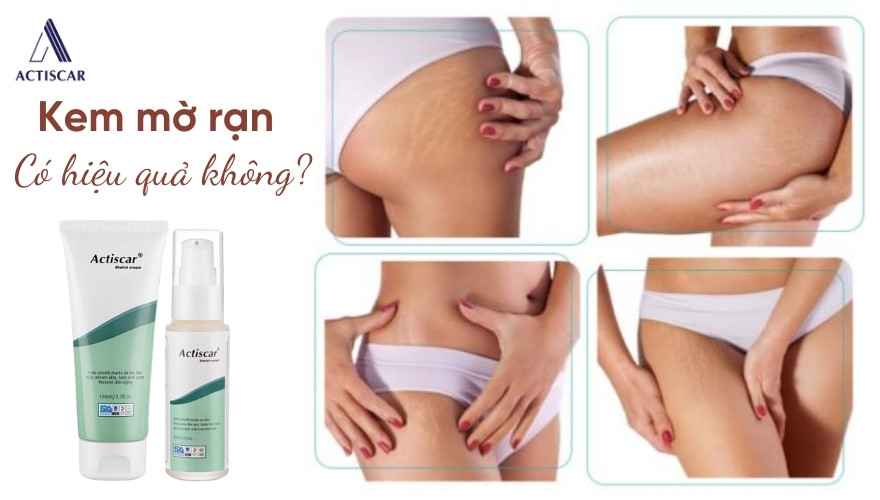 Review kem trị ran da lâu năm có hiệu quả hay không