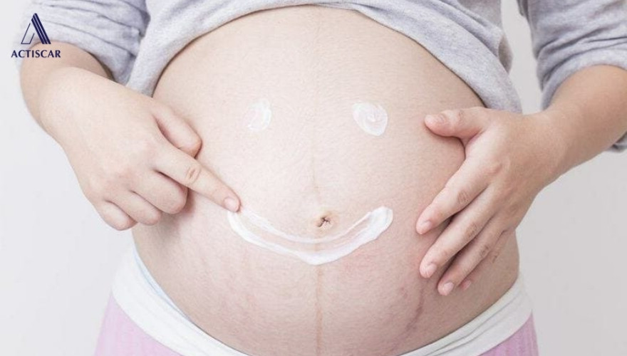 Sử dụng thêm các sản phẩm hỗ trợ trị ngứa an toàn