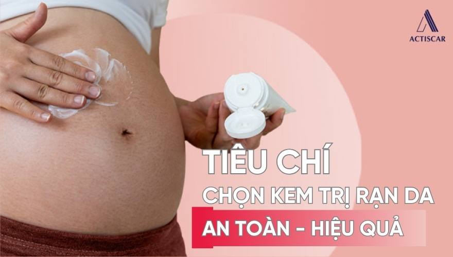 Tiêu chí khi chọn kem trị rạn da cho bà bầu