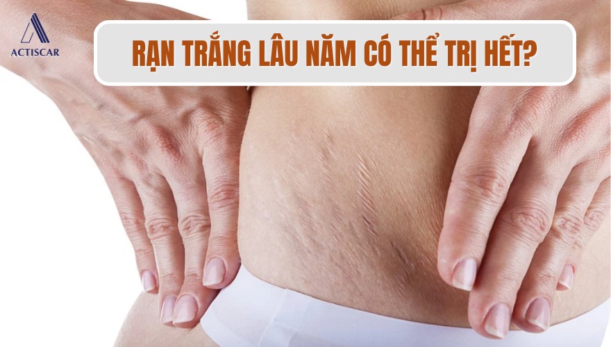 Tình trạng rạn da trắng lâu năm có hết được không