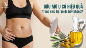 Trị rạn da bằng dầu mù u có hiệu quả hay không