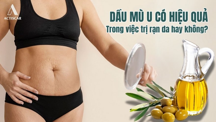 Trị rạn da bằng dầu mù u có hiệu quả hay không