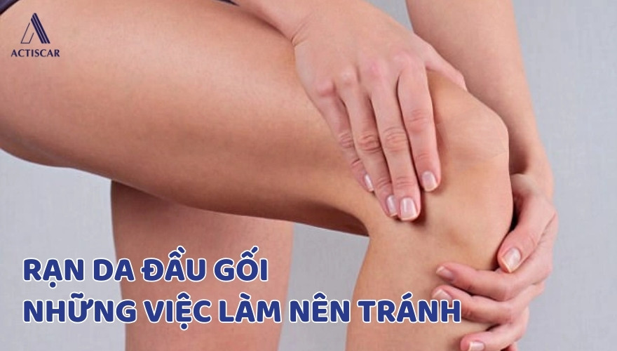 Việc nên tránh khi cải thiện rạn da đầu gối