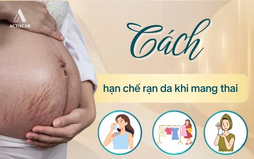 Các phương pháp giúp chống rạn bụng khi mang thai