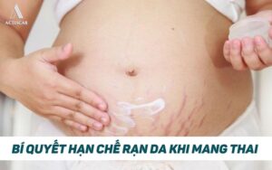 Cách giúp hạn chế rạn da khi mang thai