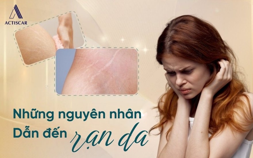 Nguyên nhân dẫn đến tình trạng rạn da