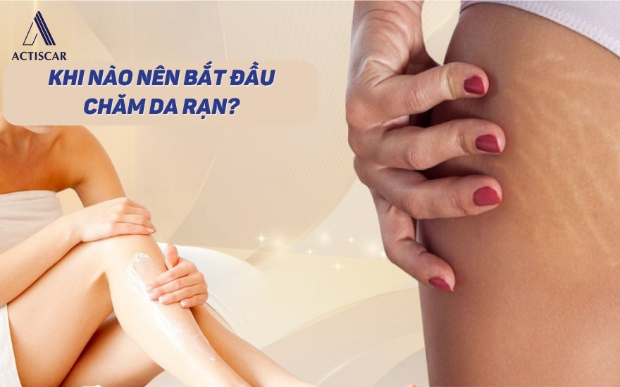 Thời gian nên chăm sóc da rạn